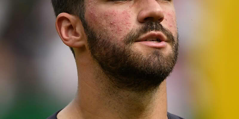 Brazil Goalkeeper Alisson Welcomes Doubts Ahead of World Cup 2026 Clash Against Morocco